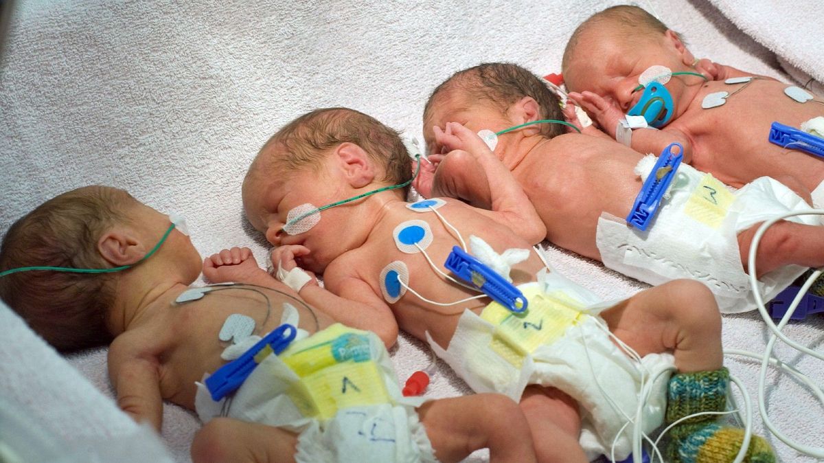 V Texasu se narodila jednovaječná čtyřčata